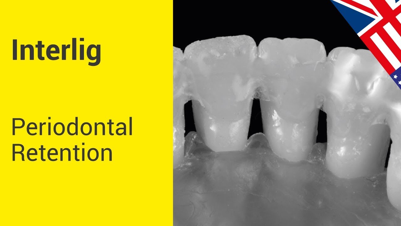 INTERLIG - Periodontal Retention