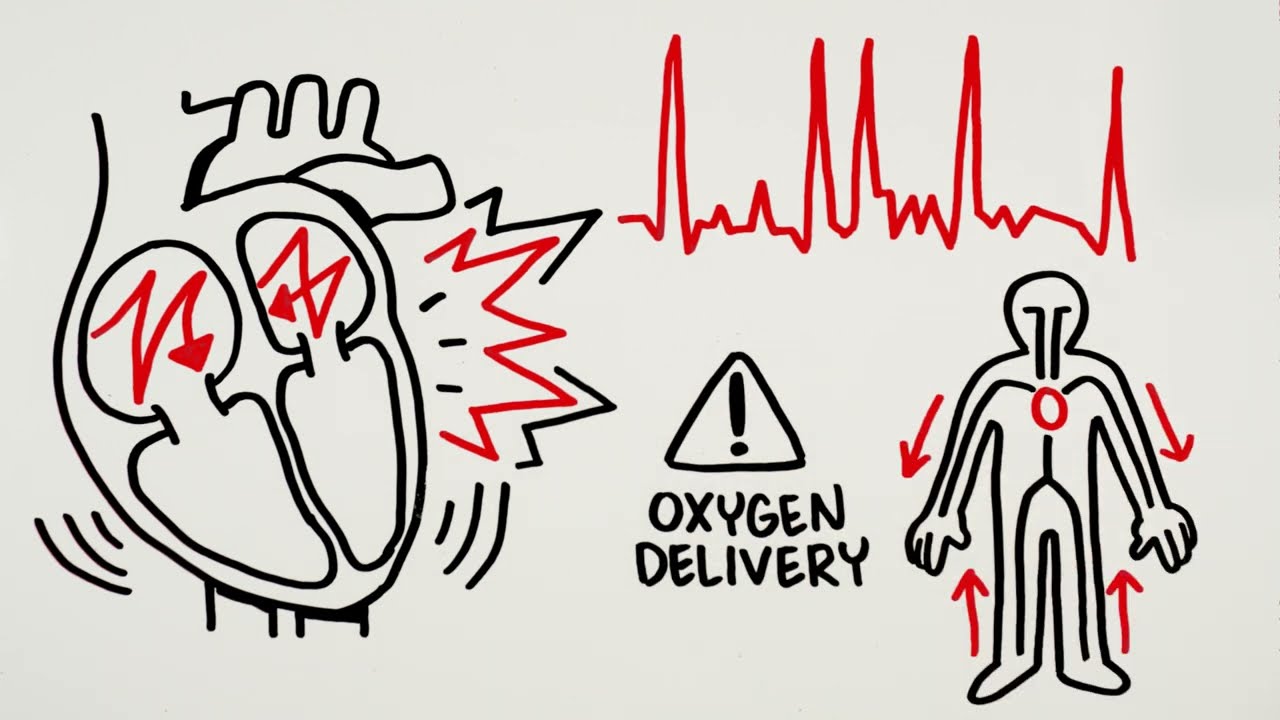 What is AFib? Symptoms, Stroke Risks, and Treatment Options Explained