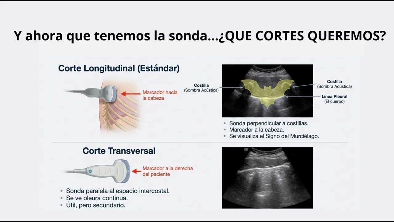 Ecografía clínica pulmonar  Samar Hassan Querol. Ugc Loreto-Puntales