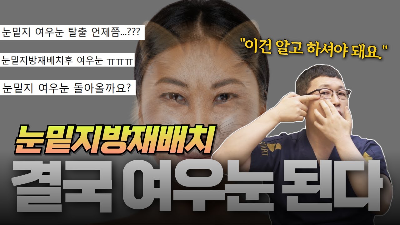 솔직히 이건 피할 수가 없습니다. 눈밑수술 10,000번 성형 전문의의 소신발언.