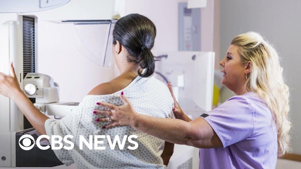 New mammogram requirements now in effect