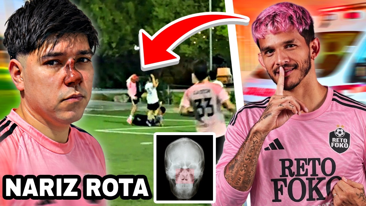 LE ROMPEN LA NARIZ EN PLENO PARTIDO y LLEGA LA AMBULANCIA 😱 Reto Foko