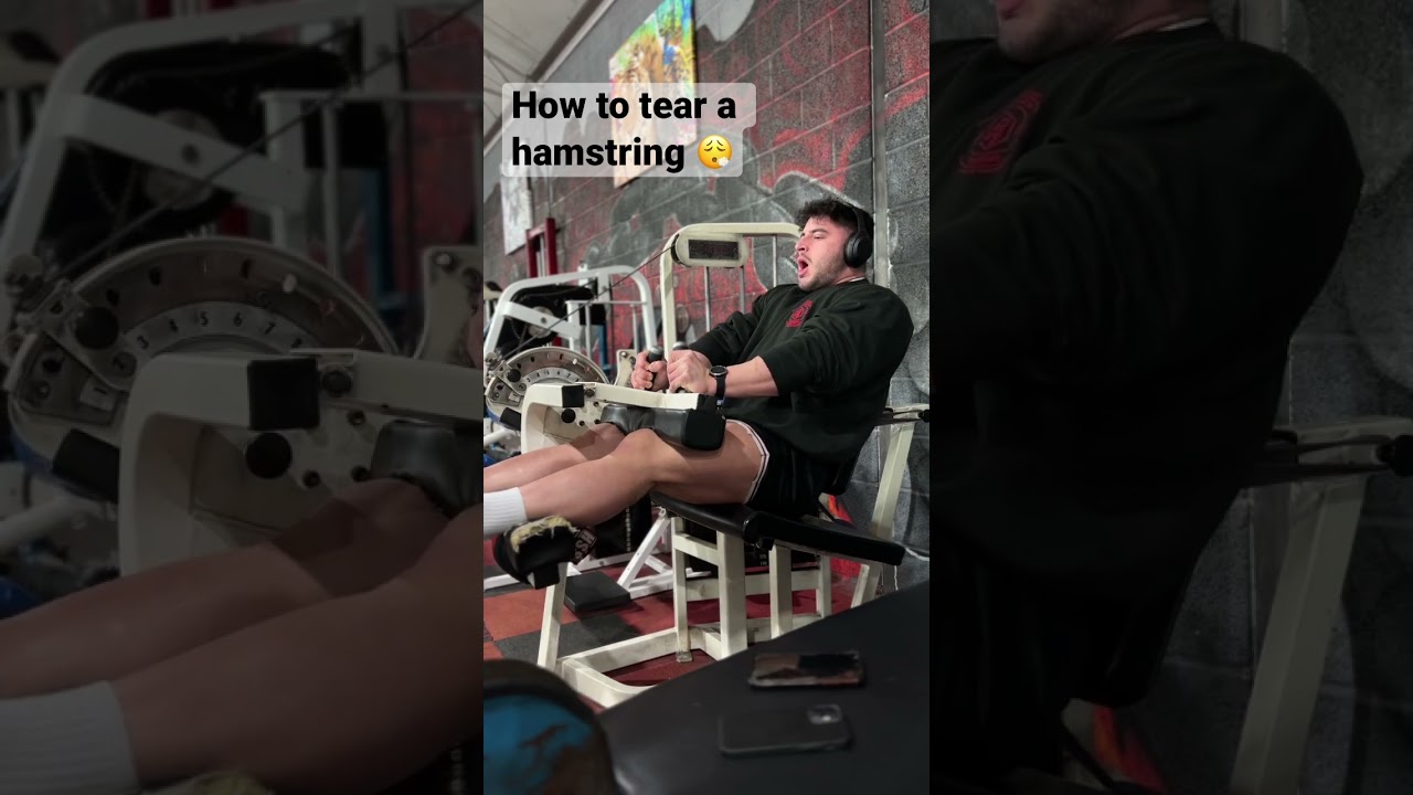 Hamstring tear 😬  
