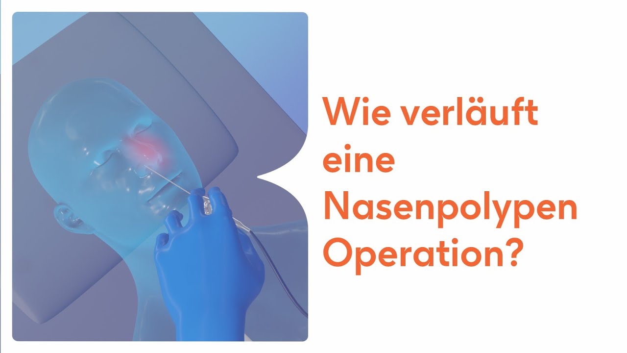 Wie verläuft eine Nasenpolypen Operation?