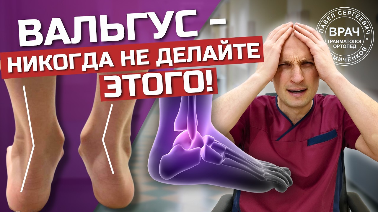 Как исправить ВАЛЬГУС у ребенка. ТОП 5 ОШИБОК родителей. Показывает ВРАЧ ортопед Павел Семиченков