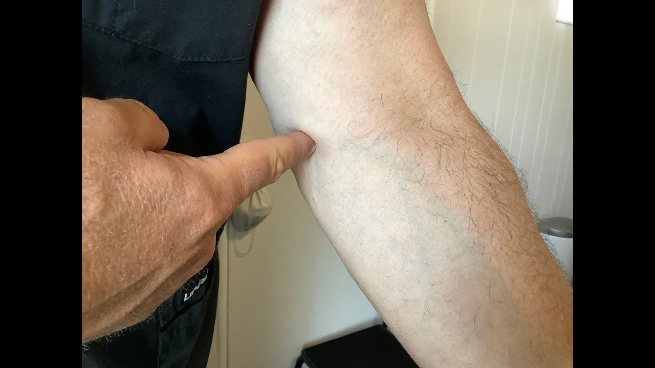 Golfers Elbow vs Tennis Elbow: Easy tip on remembering