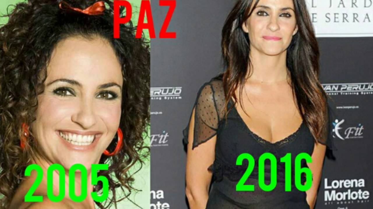 AÍDA ANTES Y DESPUÉS