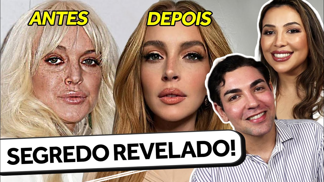 DESVENDANDO A NOVA MODA DOS PROCEDIMENTOS ESTÉTICOS ft DOUTORA GEÓRGIA *tomaram a substancia?