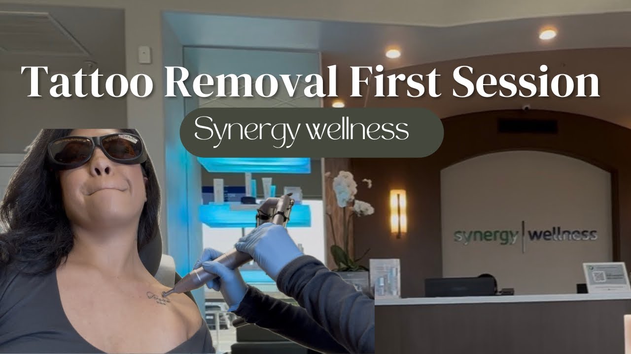 ✨ MY REAL TATTOO REMOVAL EXPERIENCE | Step by Step at Synergy Wellness 💉