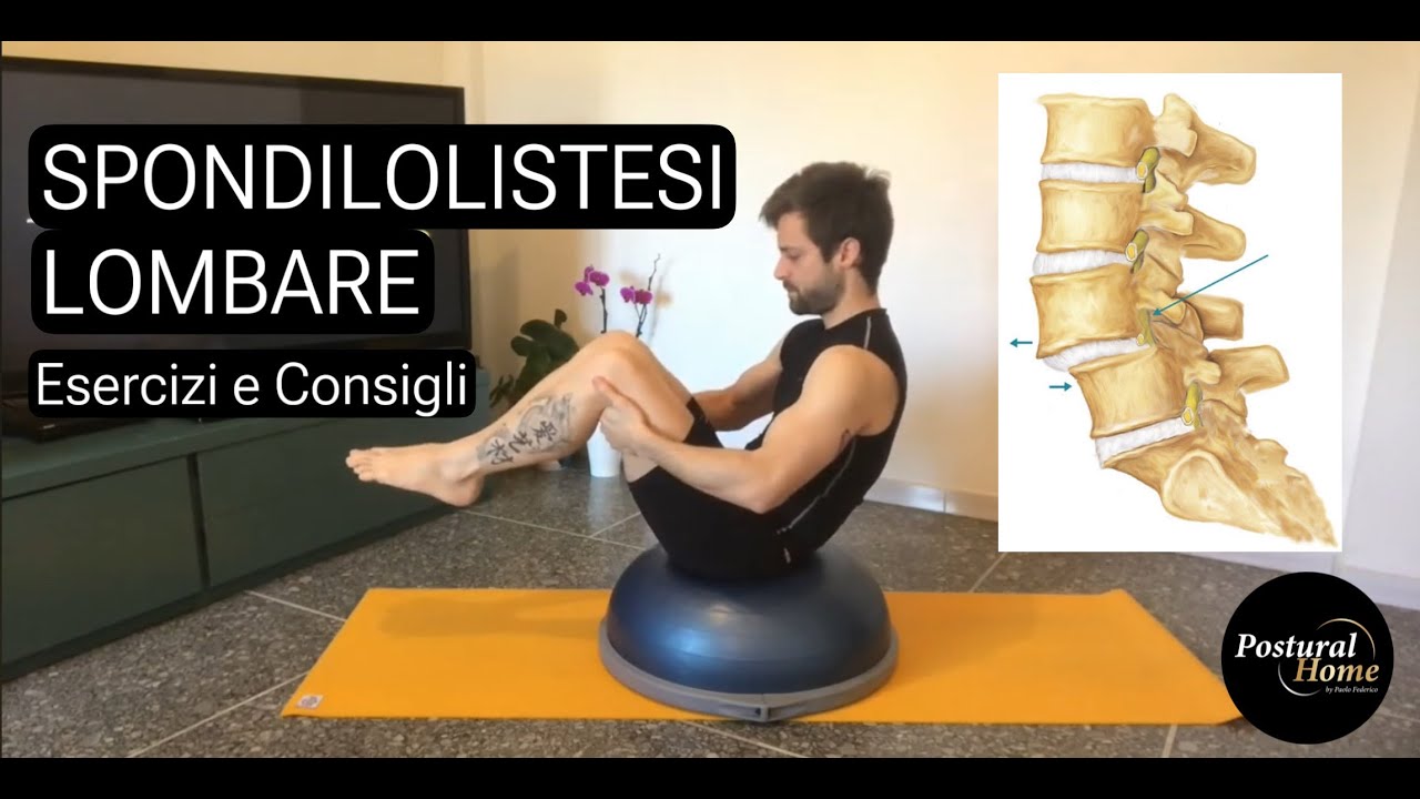 Spondilolistesi: video esercizi e consigli - Metodo Postural Home®