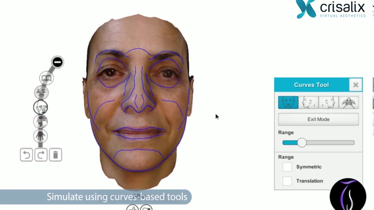 Tim Sayed MD Crisalix Simulation of Face Procedures
