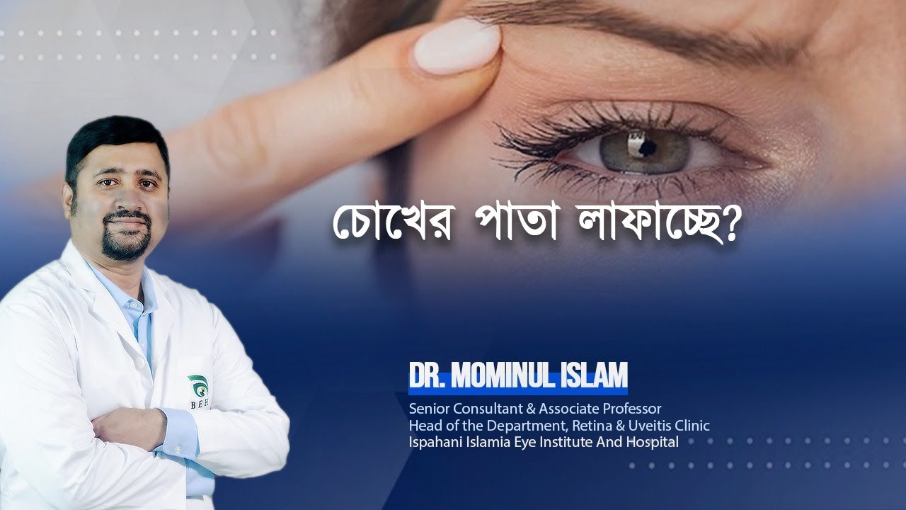 চোখের পাতা লাফাচ্ছে।।  Vibration eye ।। Dr. Mominul Islam ।।