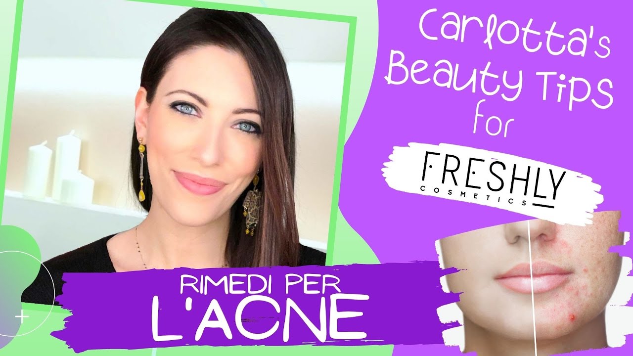 I migliori rimedi per l'ACNE e per i brufoli (a tutte le età)
