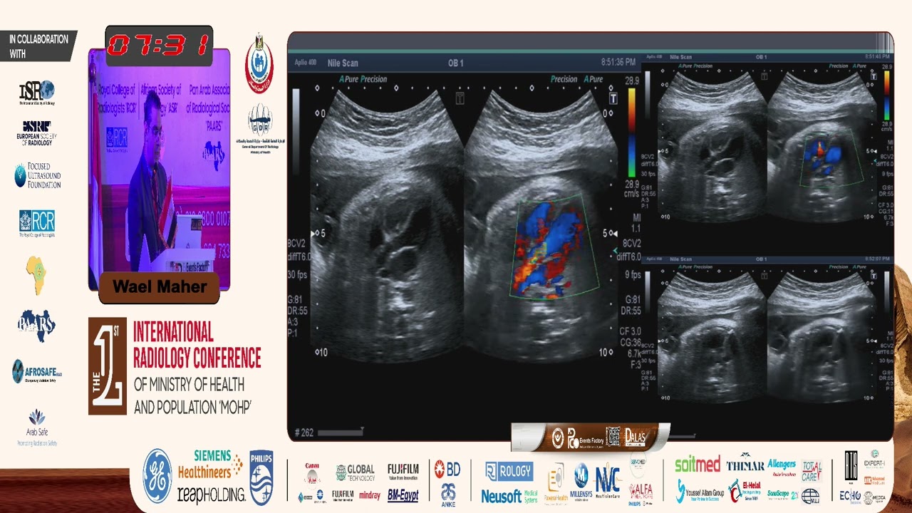 Fetal Echocardiography Made Esasy