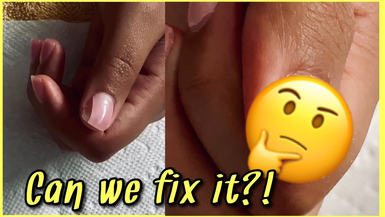 Fixing Cracked Powder Nails 💅🏽| WILL IT WORK?| KIARA SKY STARTER KIT