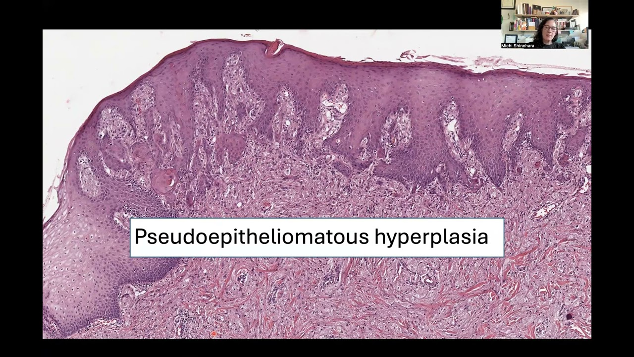 Intro to Dermpath: Common Structures & Terms in Dermpath