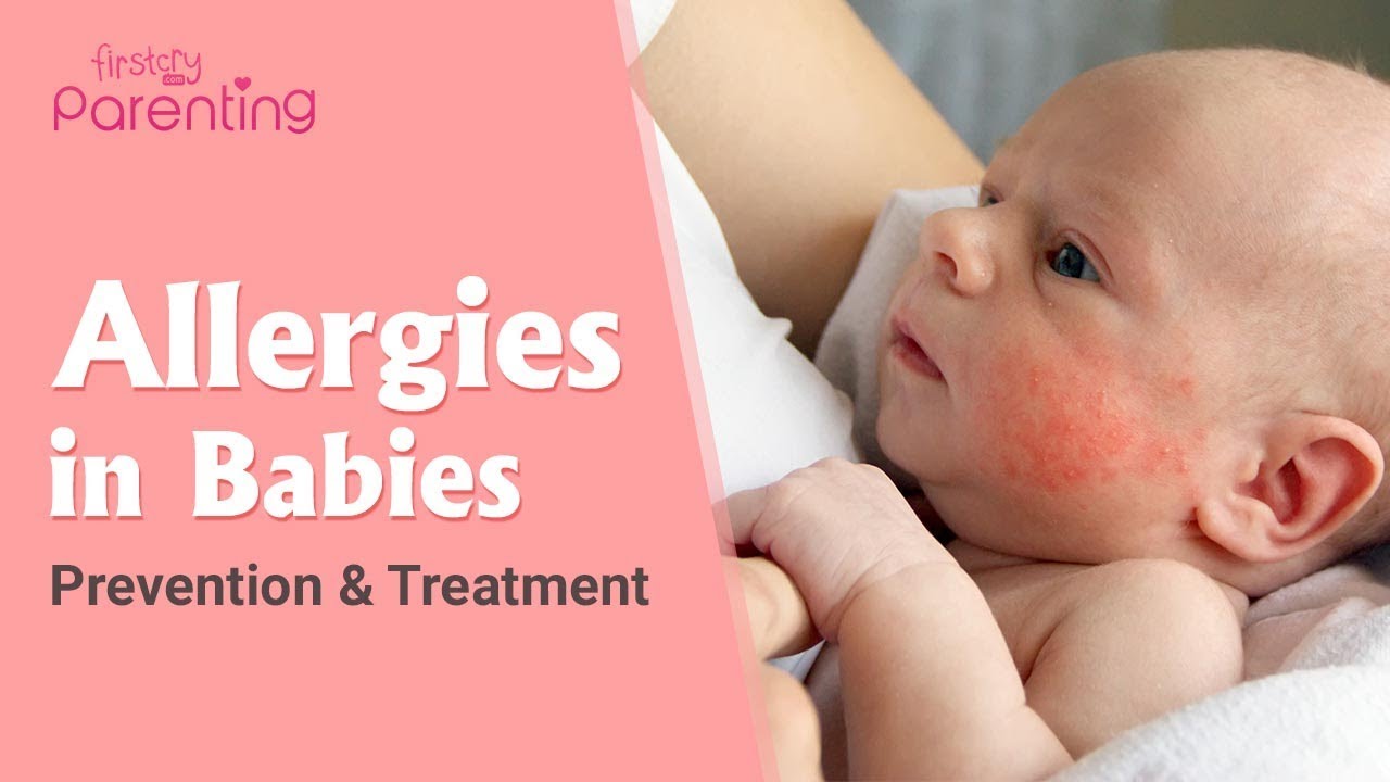 Common Allergies in Babies and How to Handle Them