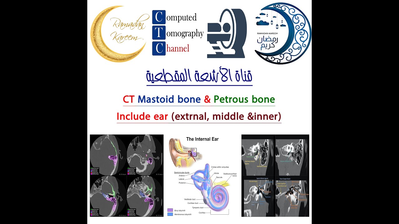 شرح عمل فحص لـmastoid bone, petrous bone وايضاً الاذن الداخلية والوسطى والخارجيه على جهازGE-64 Slice