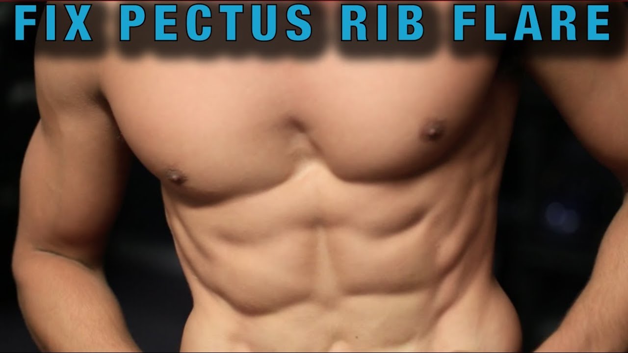 A Great Exercise to Fix Rib Flare [Pectus Excavatum]