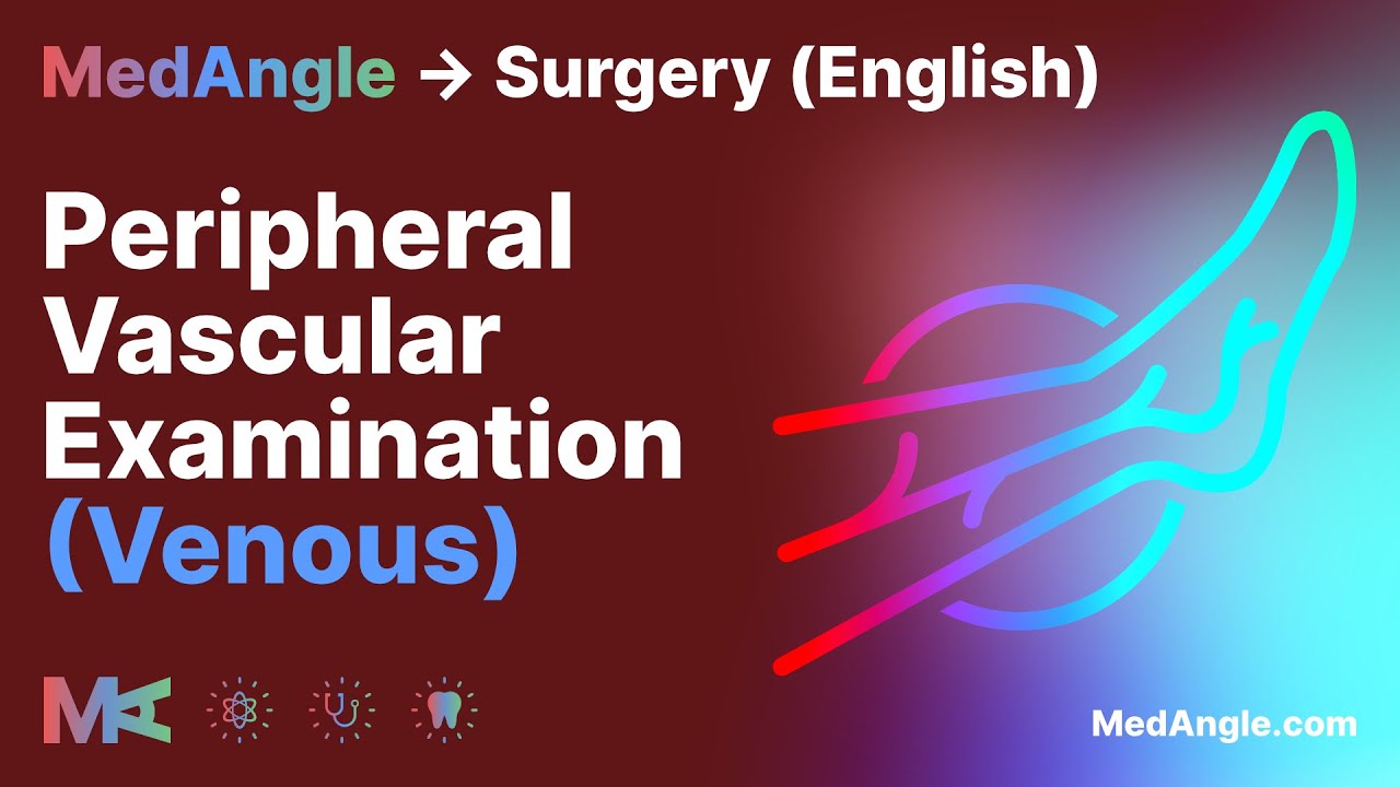 Peripheral Vascular Exam (Venous) - MedAngle Surgery (English)