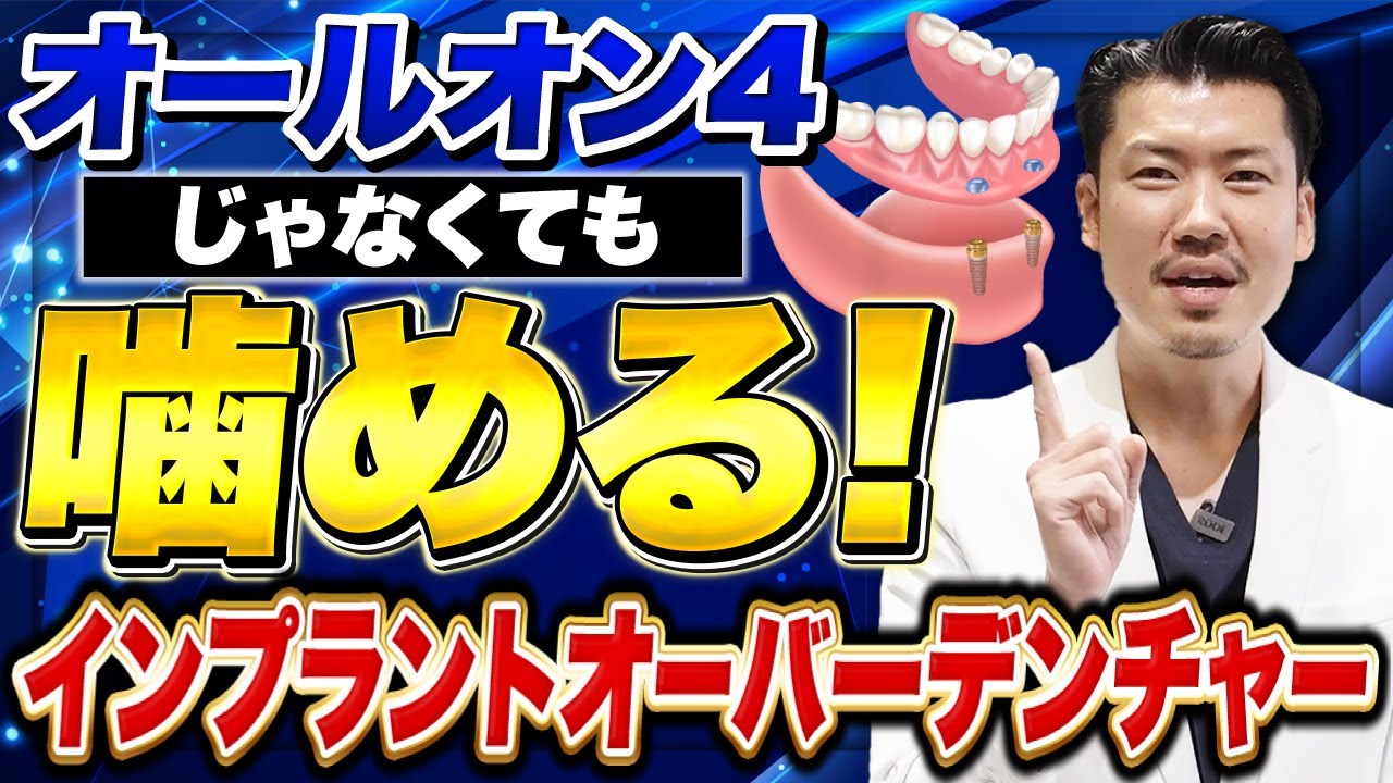 オールオン４じゃなくても噛める！インプラントオーバーデンチャー