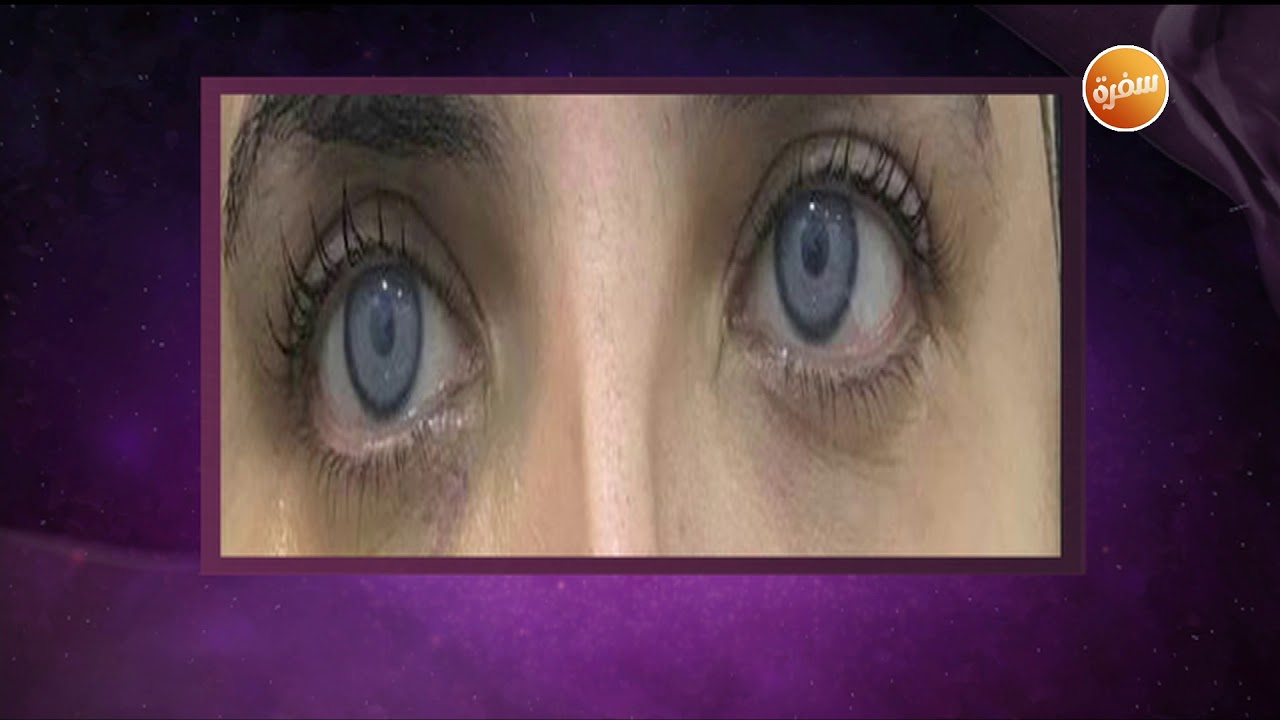 أي خطأ في عمليات العيون يتسبب في فقد النظر | هي وبس