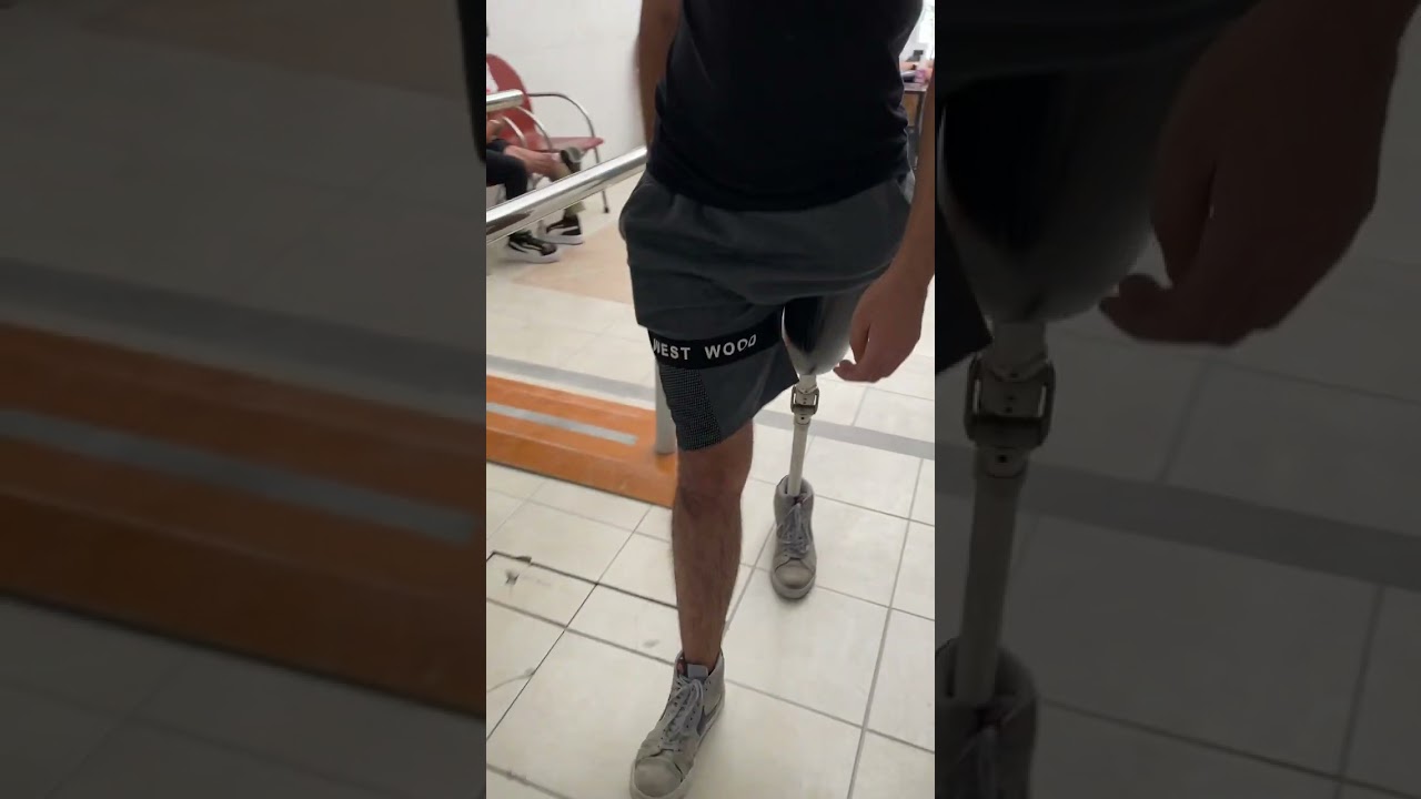 Transfemoral #amputee rehab #prosthetics #shorts #artificiallimb #amputado