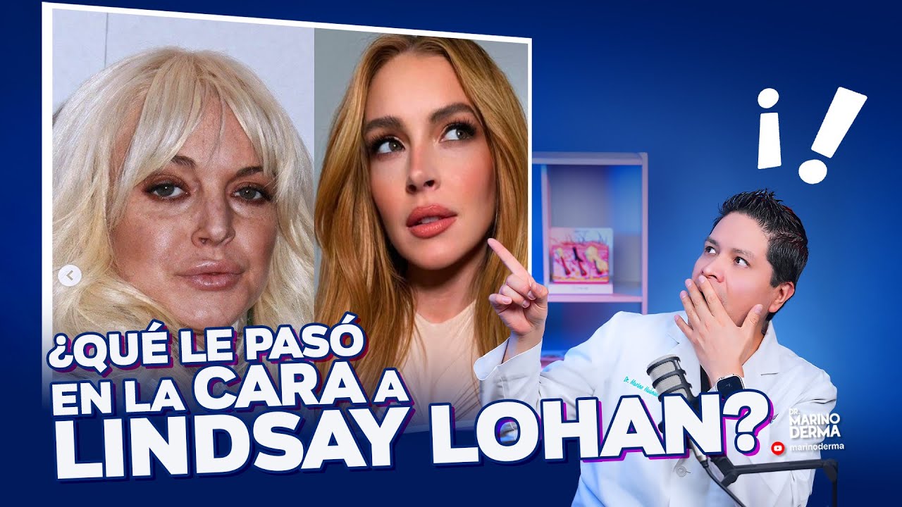 ¿QUÉ SE HIZO EN LA CARA LINDSAY LOHAN? || Dermatólogo opina