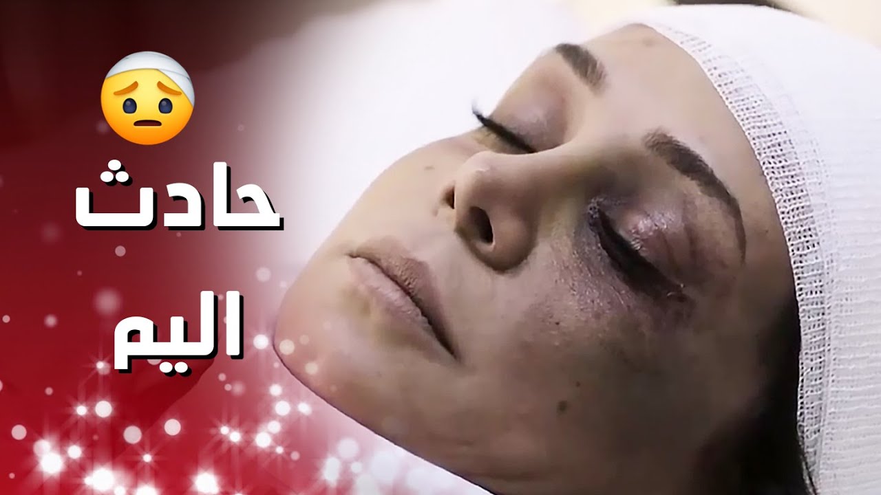بعدما اكتشفت خيانة زوجها طلعت من البيت متل المجنونة وع اثر هالشي عملت حادث فظيع_اهل الغرام3