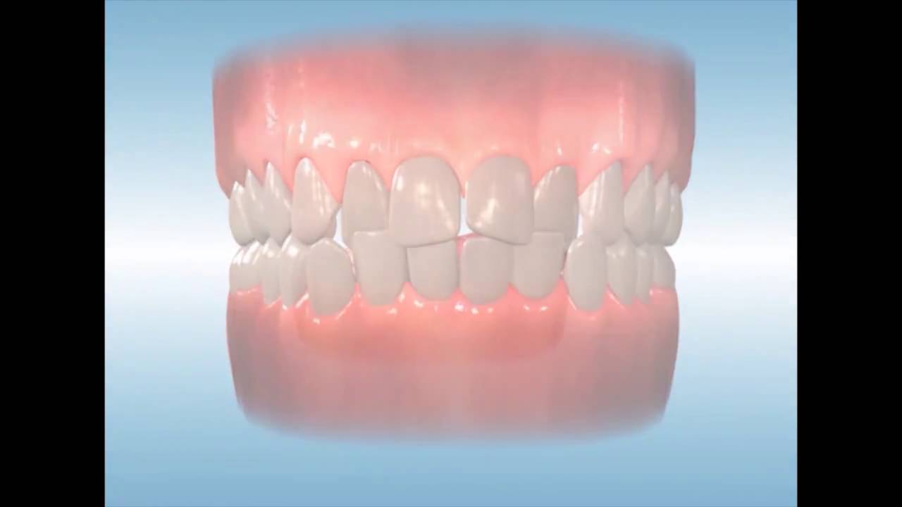 PROPEL Orthodontics