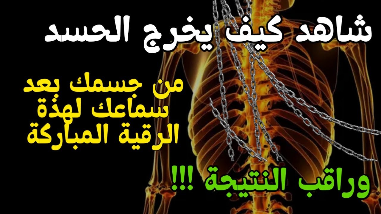 الرقية الشرعية كاملة لعلاج السحر والمس والعين والحسد وحفظ وتحصين المنزل وجلب البركة - علاء عقل