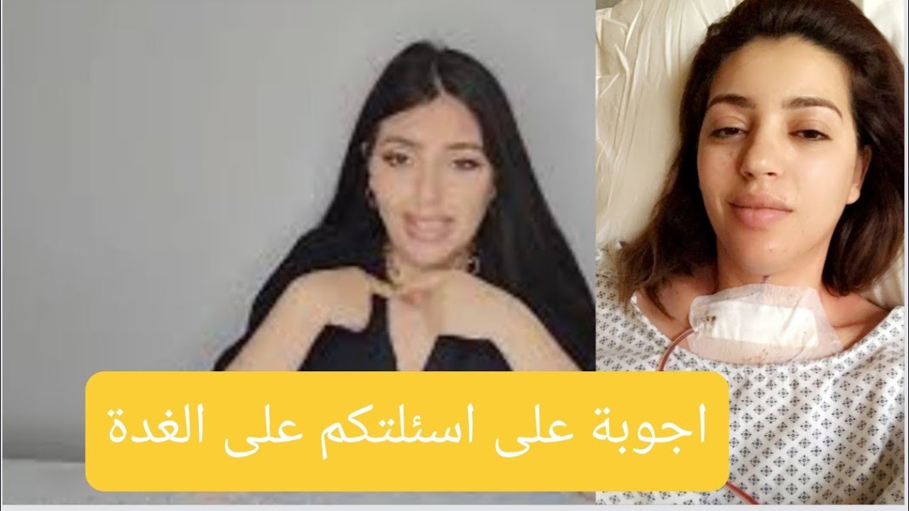 غدة درقية جاوبت على اسئلة لي سولتوني ضروري تردو بالكم   مديروش بحلي