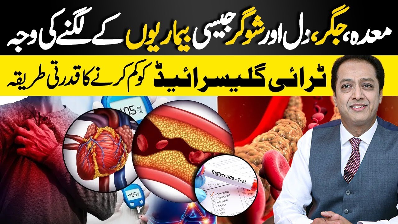 Triglycerides Are High! Control Triglycerides without Medicine | Dr Shahid Nadeem