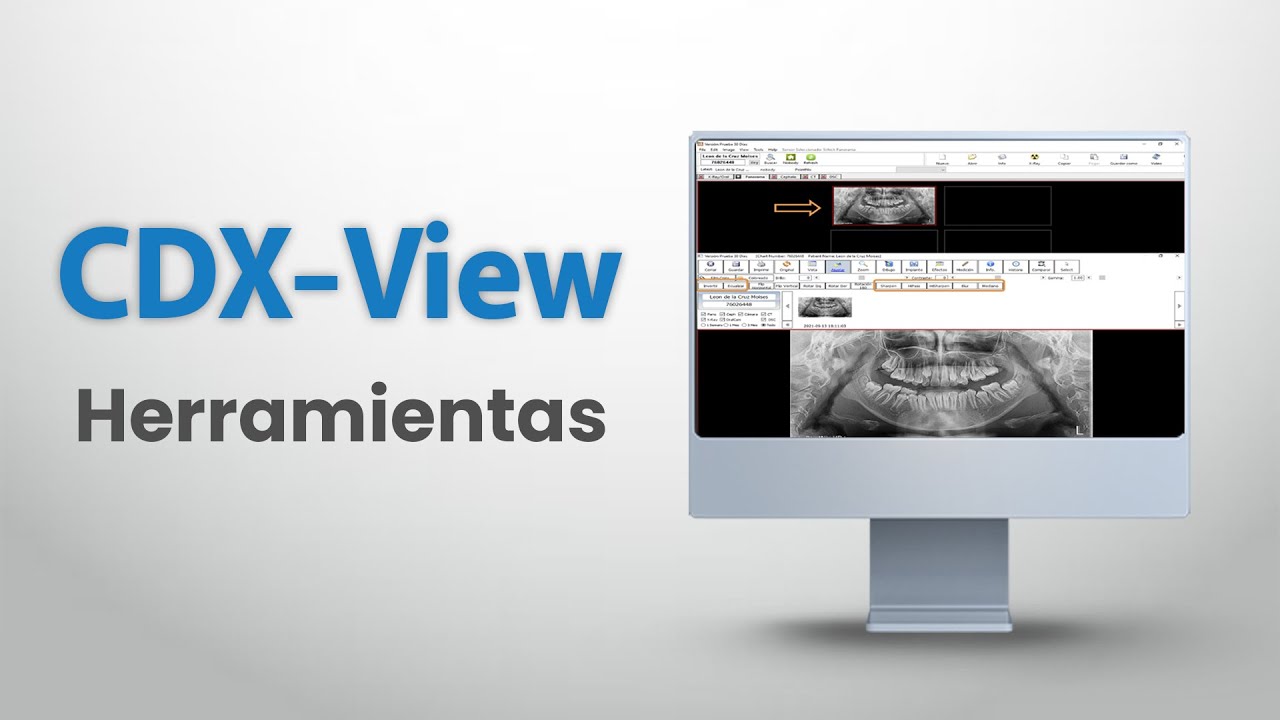 CDX-View (Herrameintas)