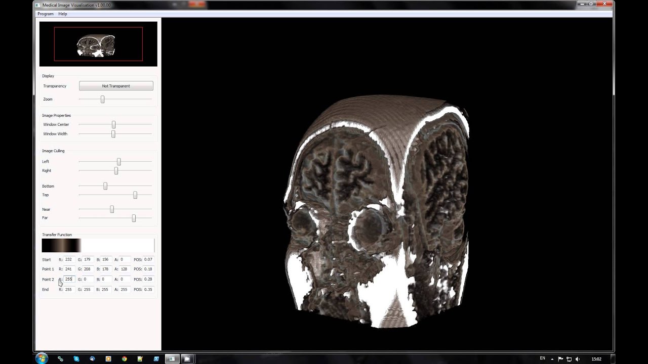 Medical image visualisation in 3D
