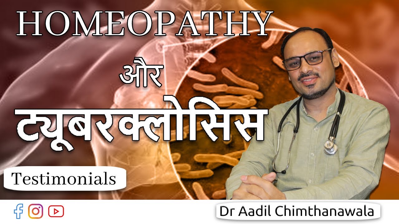 Patients Tuberculosis reduced | Homeopathy with Dr. Aadil Chimthanawala