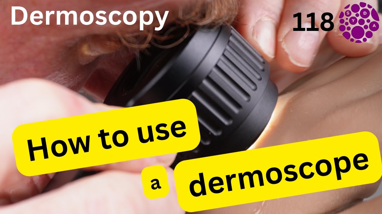 How to use a Hybrid Dermoscope and 10 top reasons people fail