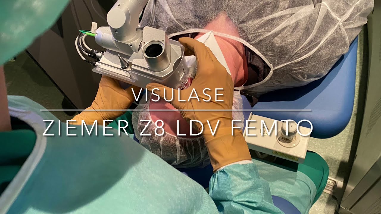 Erzeugung eines femto-Flap mit dem ZIEMER LDV Z8 (#VisuLASE Dr.Zenk)