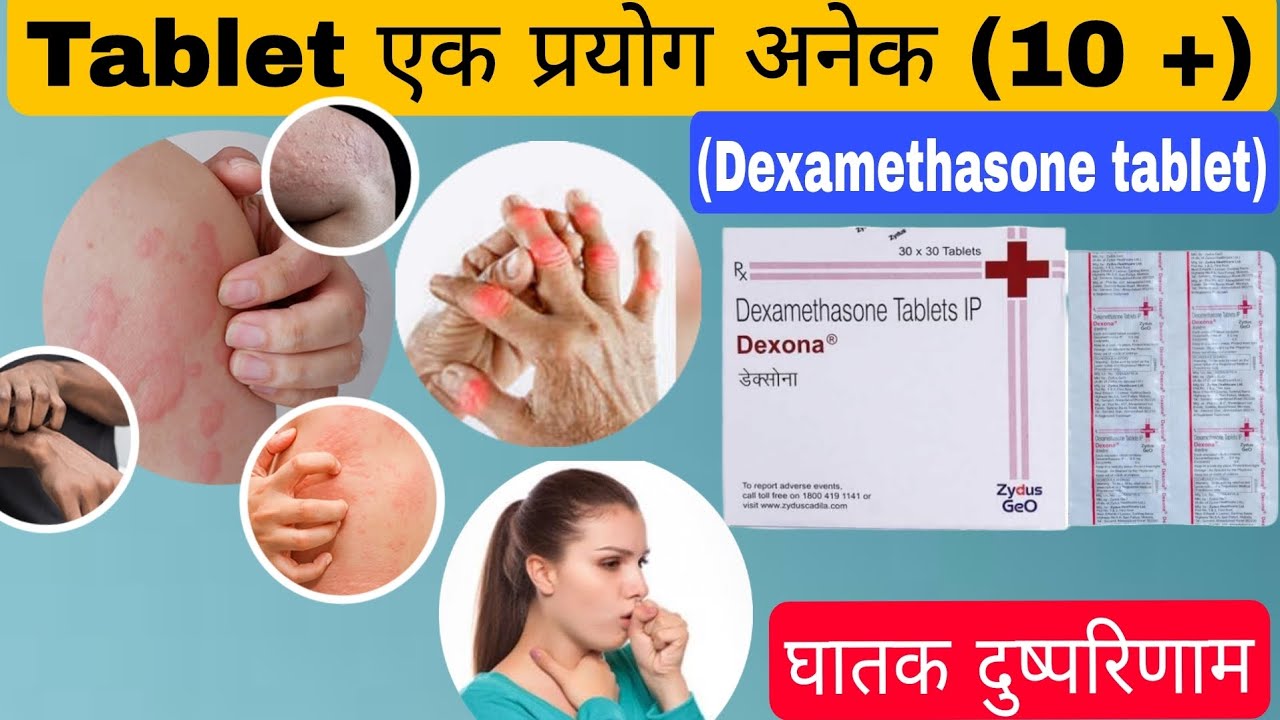ज्यादातर प्रयोग वाली Tablet | Dexona tablet uses in hindi | Dexamethasone tablet