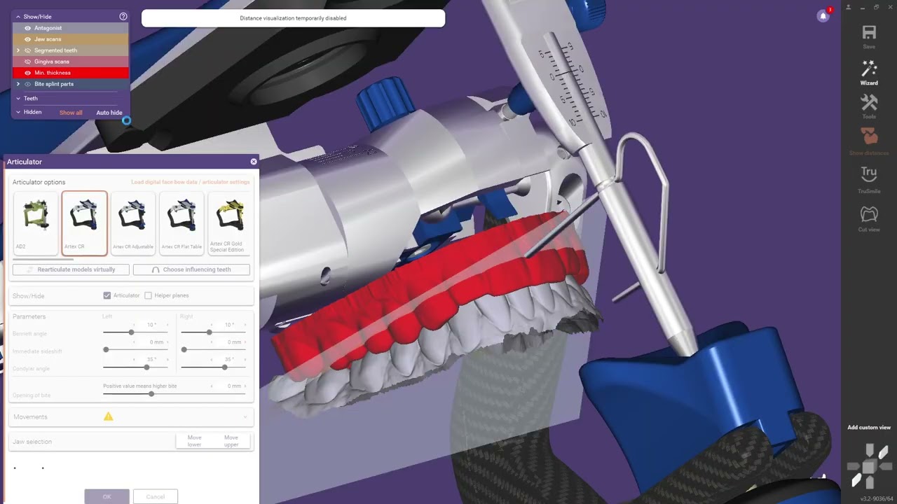 How to Design a Canine Guidance Occlusal Splint in exocad (Full Tutorial)