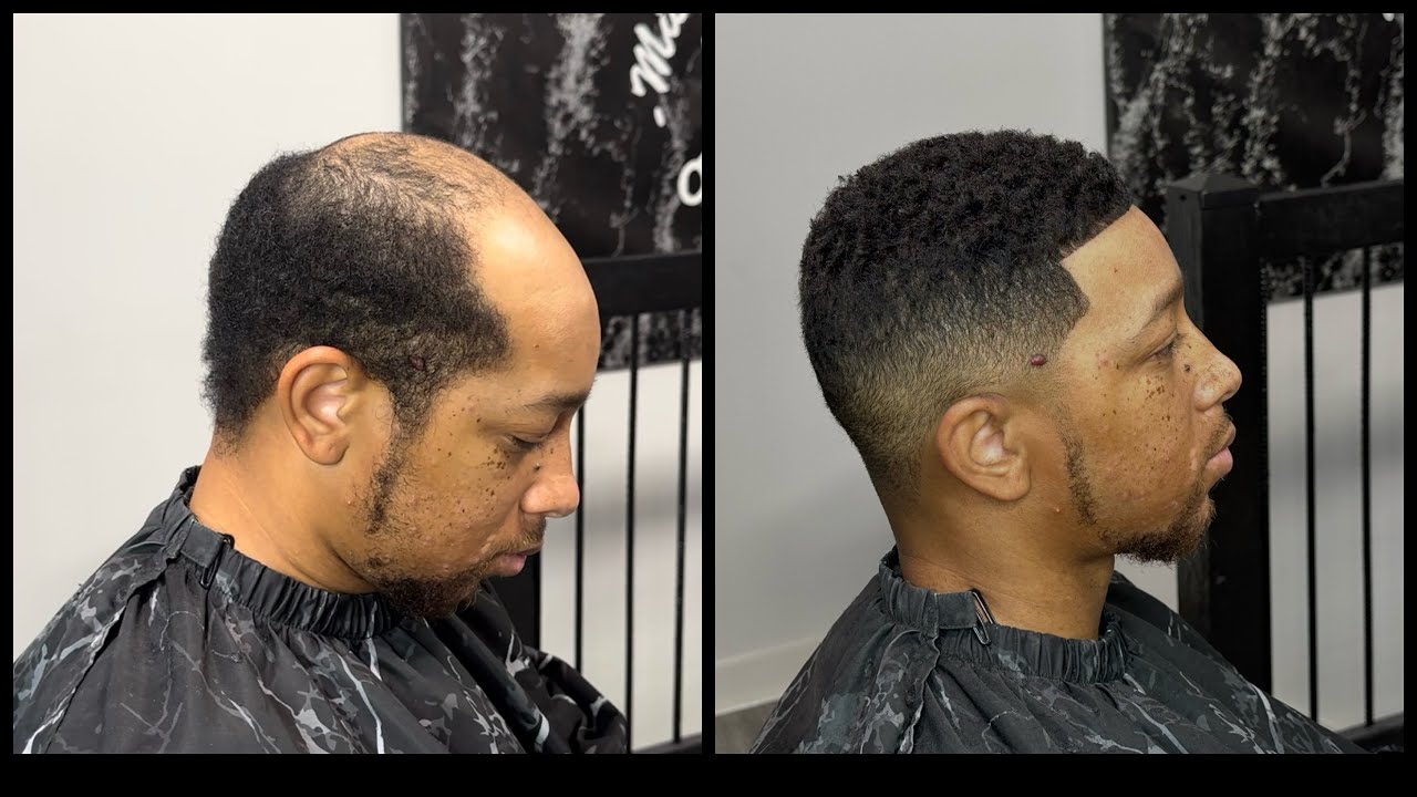 Step-by-step tutorial of How to apply a toupee( hair unit)