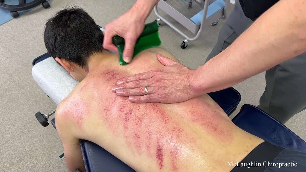 Its Almost Unbelievable...A Man So Young Shouldn't Have This Much Back Pain - Helping Him Break Free