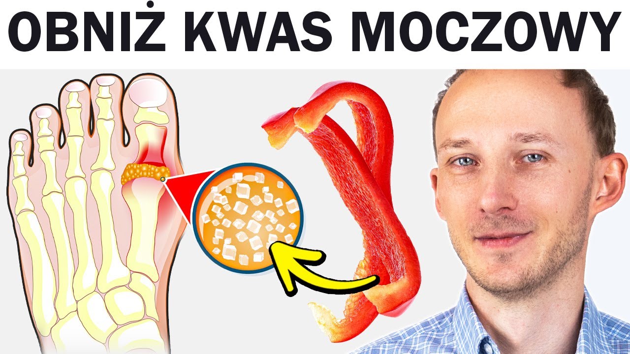 Dna moczanowa i wysoki kwas moczowy: co jeść, by złagodzić ból stawów i uchronić zdrowie