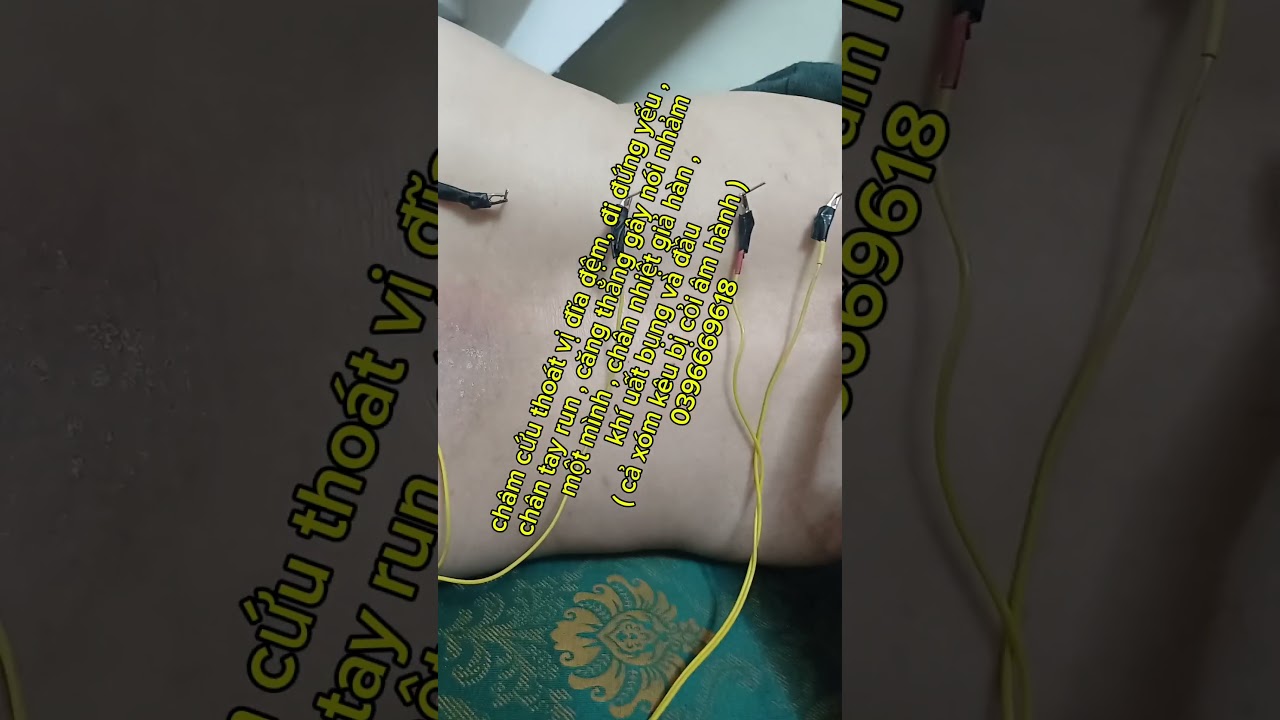 #chamcuu #giachoi #nanchinhcotsong #tacdongcotsong #suynhuoccothe #thankinhsuynhuoc #thoatvidiadem