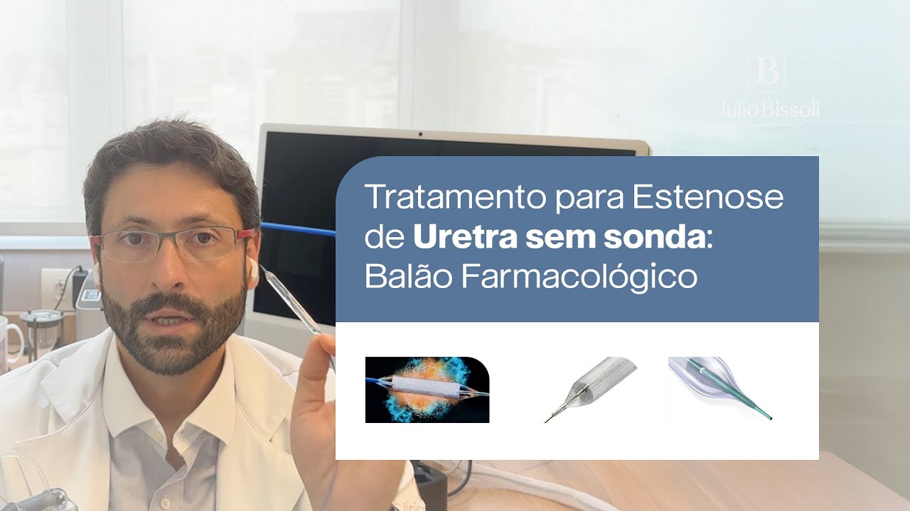Tratamento para Estenose de Uretra SEM SONDA: Conheça o Balão Farmacológico