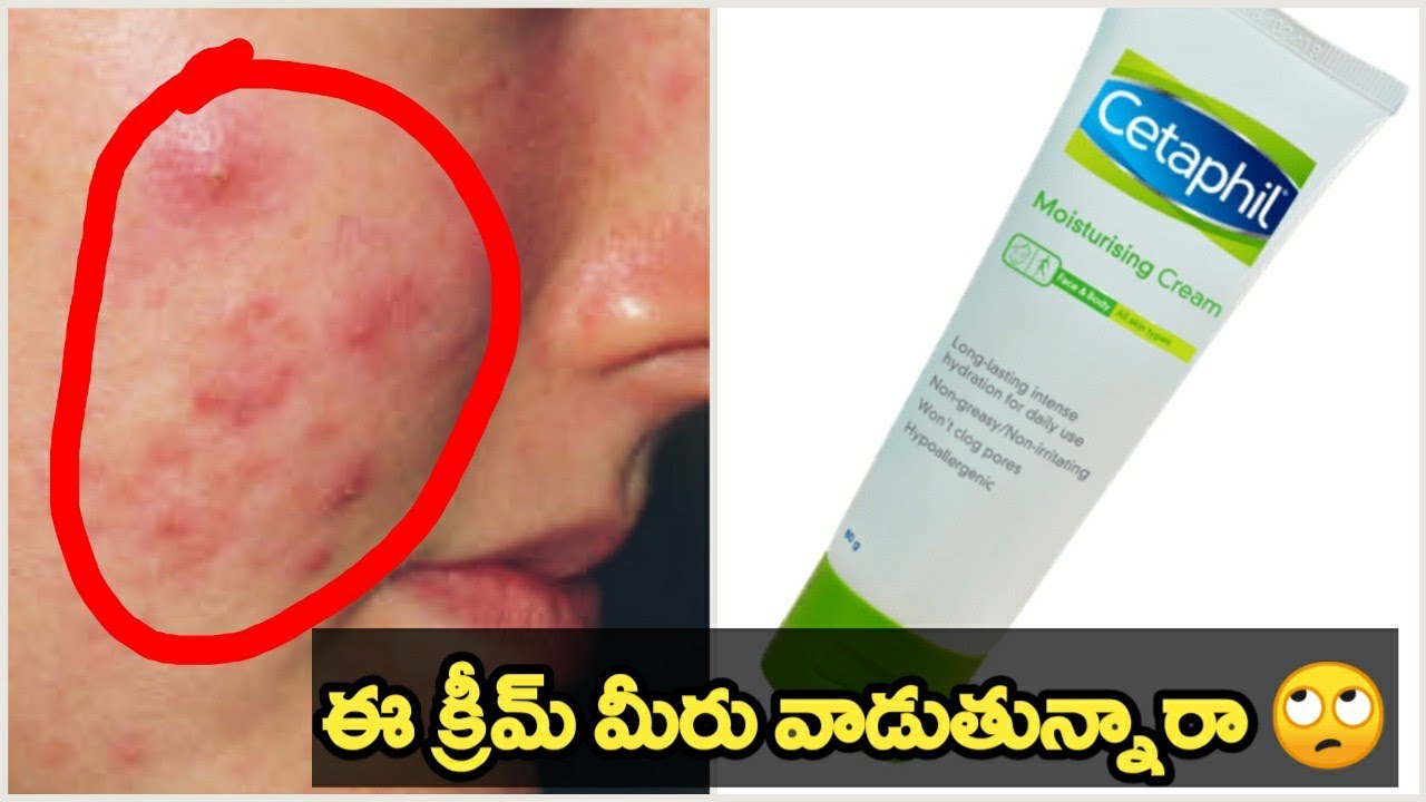 Cethaphil moisturising cream review in telugu|| side effects of cetaphil moisturising cream||