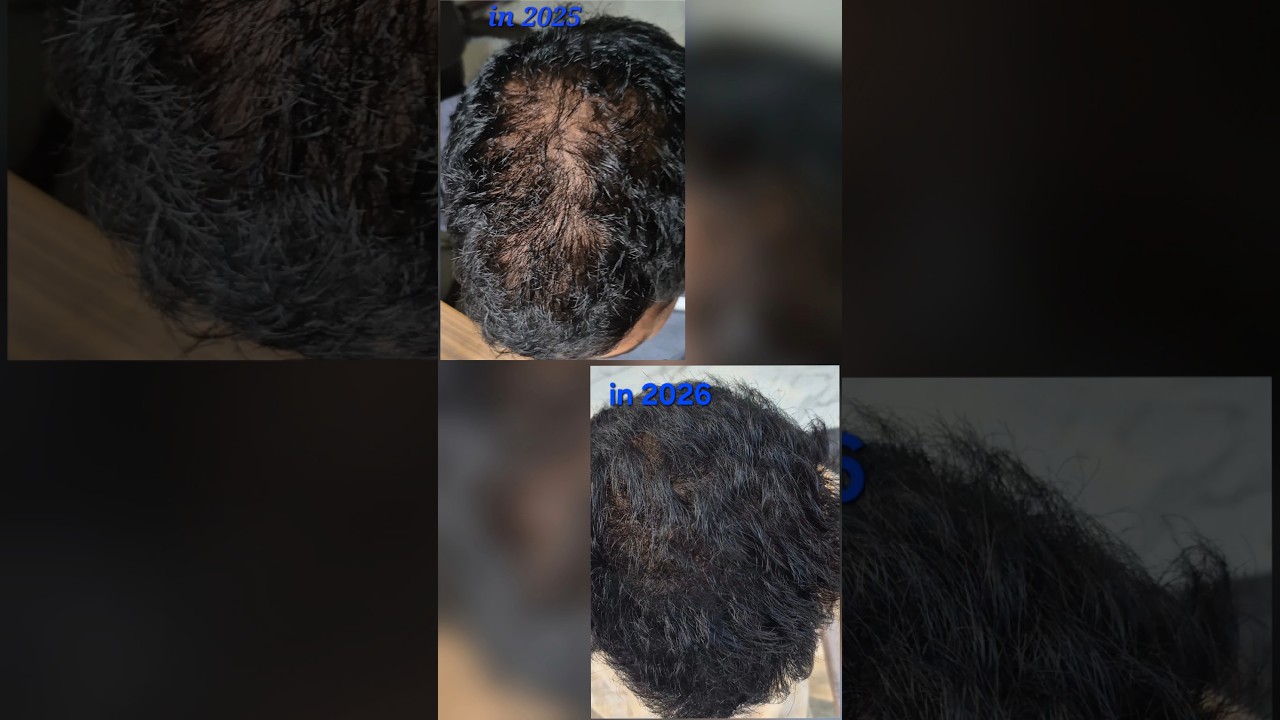 hairgrowth 🤫 