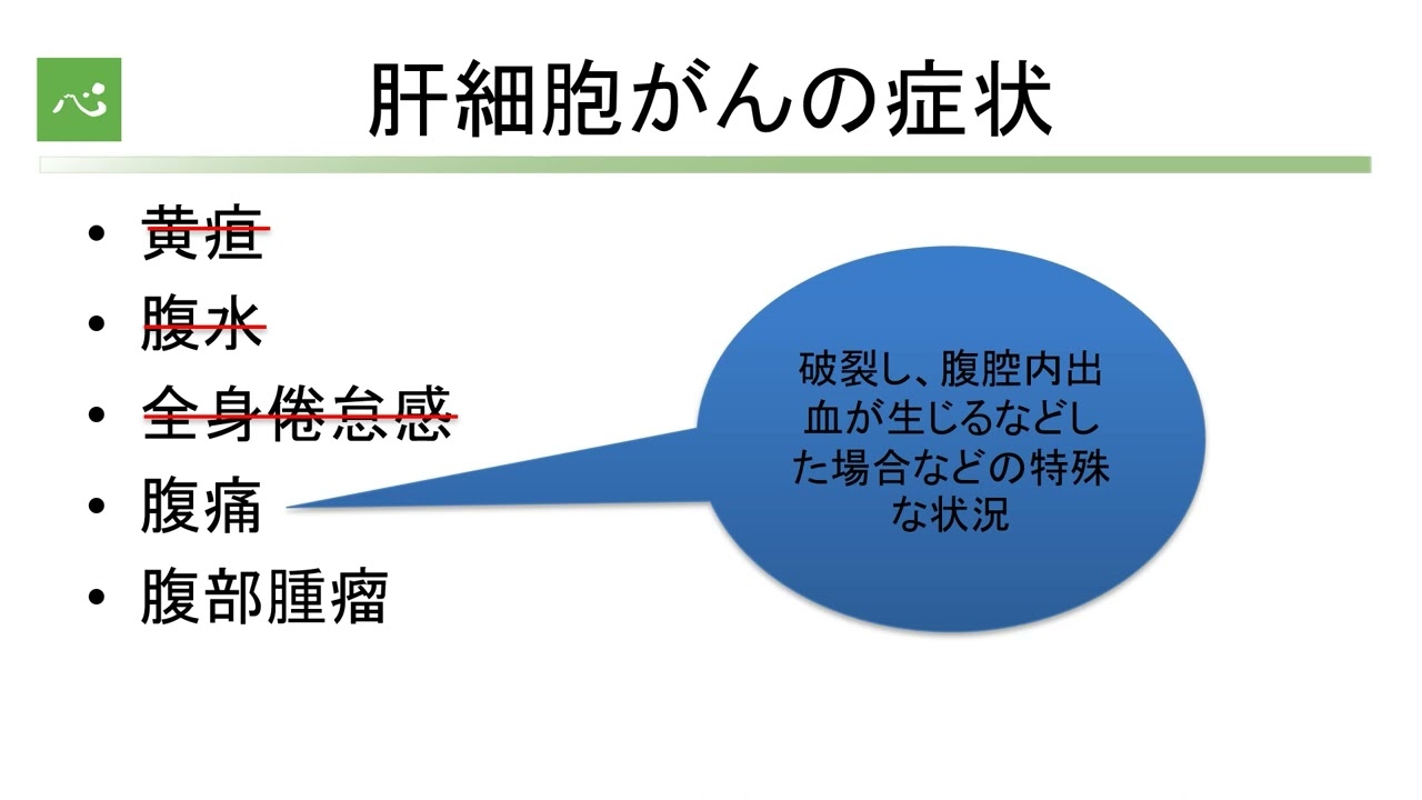 肝臓がんの内科的治療（IVR・抗がん剤治療）