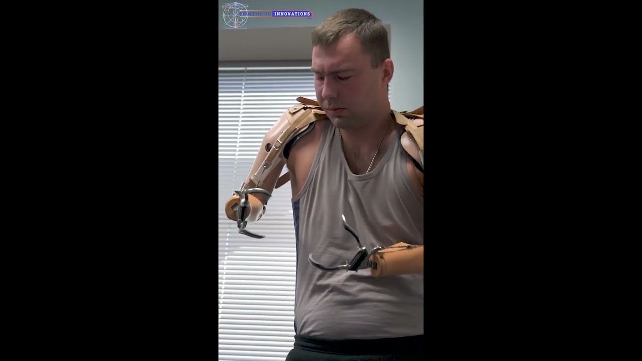 Upper Extremity Body Powered Prosthetics | Prosthetic Innovations
