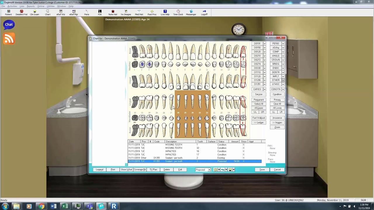 Eaglesoft Dental Charting